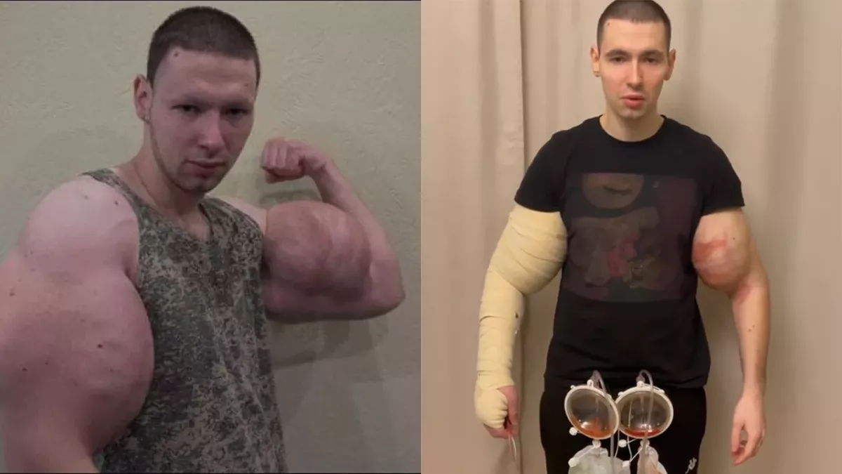 Le Synthol Kid affiche son état de santé très inquiétant sur Instagram 