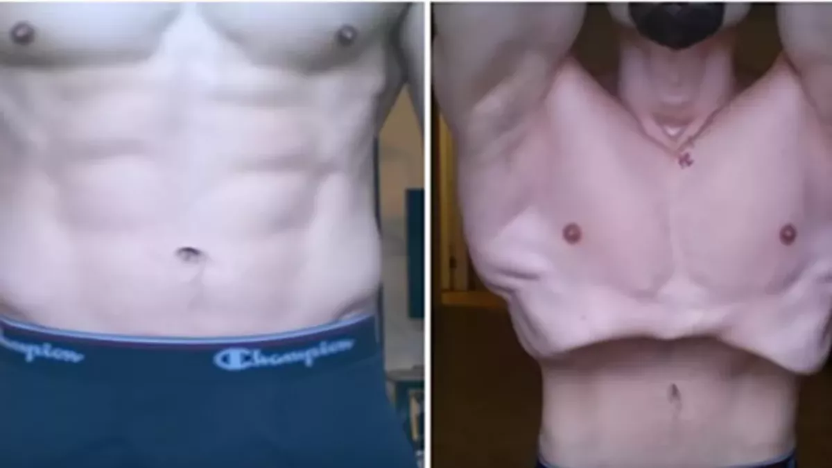 Abdos