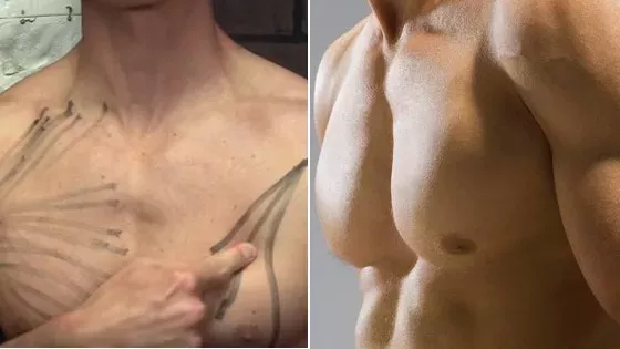Musculation