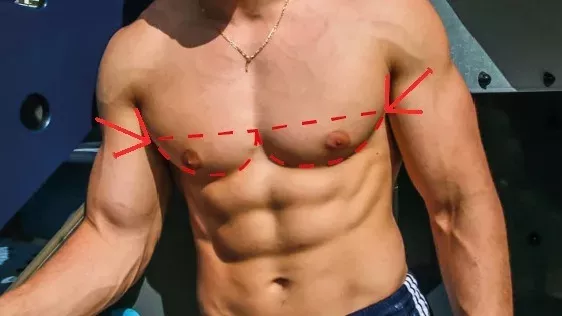 Pecs