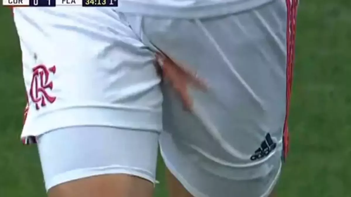 Un Brésilien se coupe les testicules et quitte la pelouse en plein match