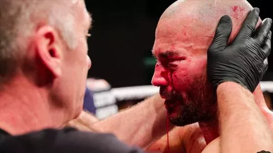 BKFC 9 : Artem Lobov
