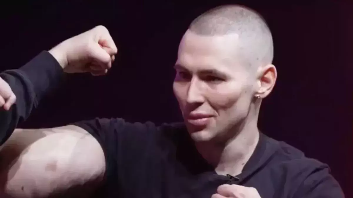 Kiril Tereshin est connu pour ses biceps imposants obtenus grâce à des injections de synthol. 