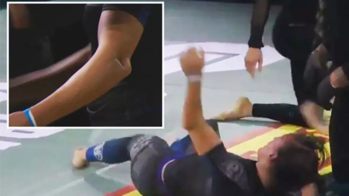 Une ancienne de l'UFC casse le bras de son adversaire sur une soumission