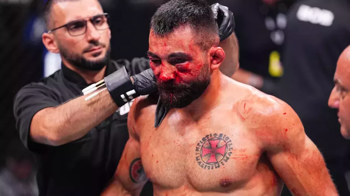 Benoît Saint-Denis et son visage marqué lors de l'UFC Paris 3.