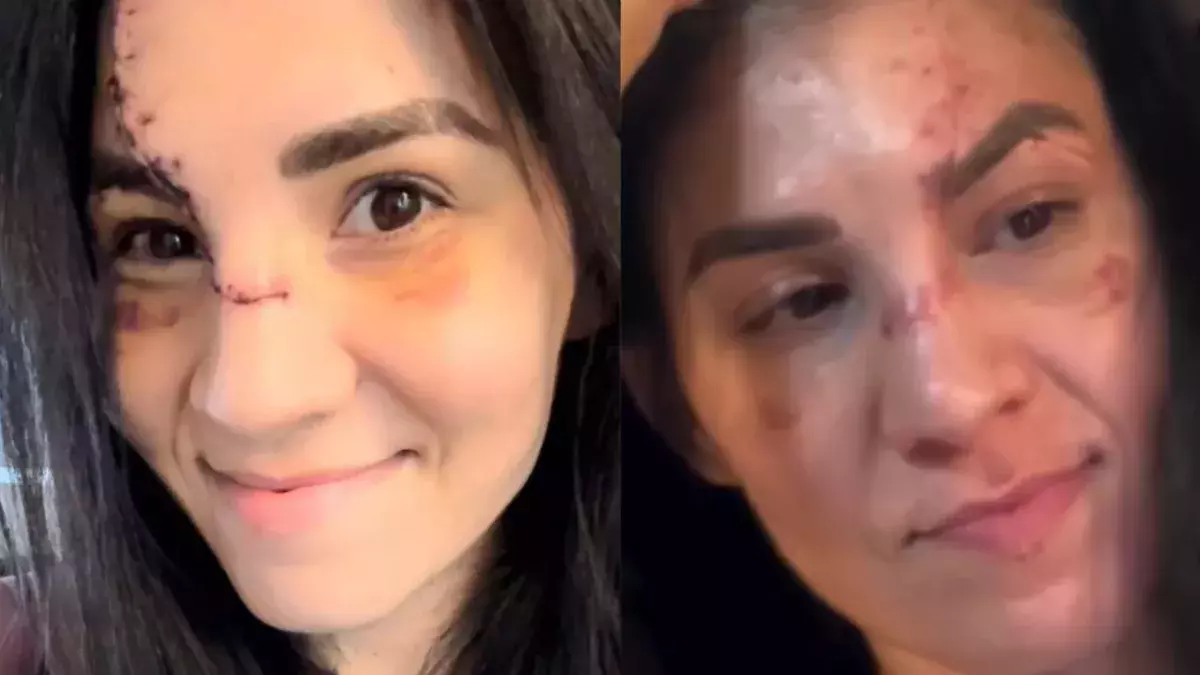 Irene Aldana affiche sa guérison