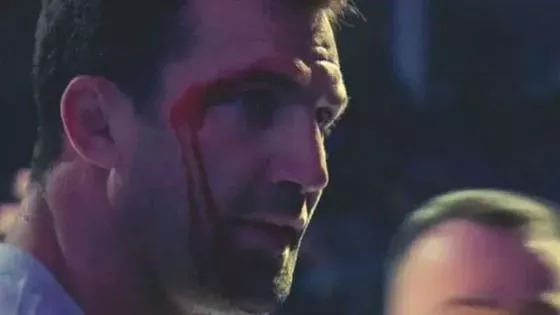 Luke Rockhold