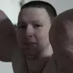 Synthol Kid :  Les terribles effets secondaires chez le fou qui s'injectait du Synthol pour avoir des bras à la Popeye