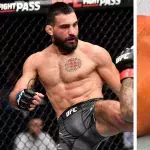 Benoit Saint-Denis s'est blessé au pied à l'UFC Paris