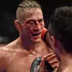 Niko Price défiguré après son combat contre Vicente Luque à l'UFC 249