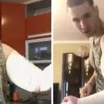 Synthol Kid s'est fait opérer des bras et nous montre l'effrayant résultat
