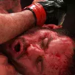 Le combat entre Ross Houston et Nicolas Dalby a dû être arrêté en raison de l'omniprésence de sang dans la cage. 