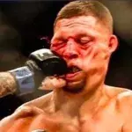 Nate Diaz