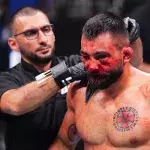 Benoît Saint-Denis et son visage marqué lors de l'UFC Paris 3.