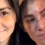 Irene Aldana affiche sa guérison