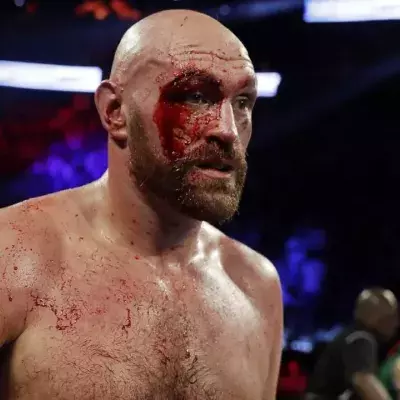 Tyson Fury a subi un grosse coupure contre Otto Wallin mais l'a quand même emporté
