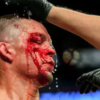 UFC 244 : Nate Diaz