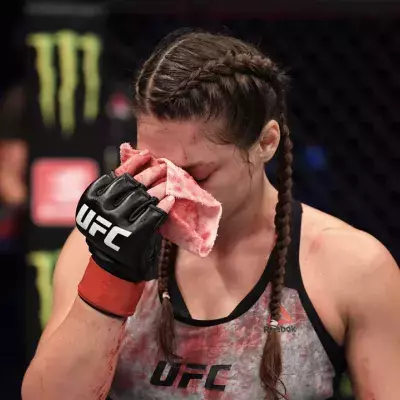 UFC 254 : L'énorme coupure au nez de cette combattante 