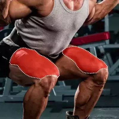 Default image