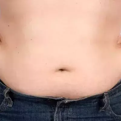 Default image