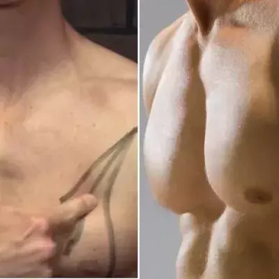 Musculation