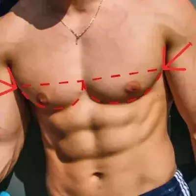Pecs