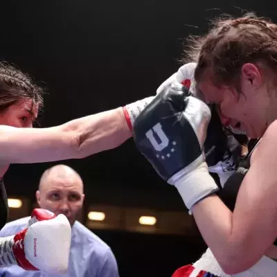 La boxeuse professionnelle Cheyenne Hanson complètement défiguré après un combat 