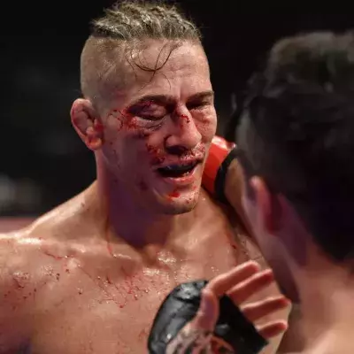 Niko Price défiguré après son combat contre Vicente Luque à l'UFC 249