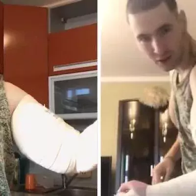 Synthol Kid s'est fait opérer des bras et nous montre l'effrayant résultat