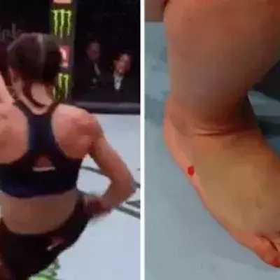 UFC