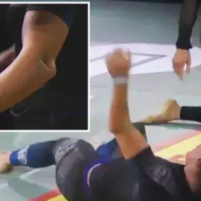 Une ancienne de l'UFC casse le bras de son adversaire sur une soumission