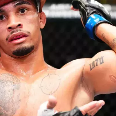 Andre Lima montrant sa morsure au biceps
