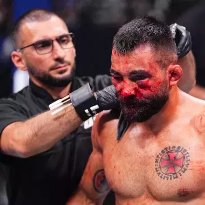Benoît Saint-Denis et son visage marqué lors de l'UFC Paris 3.