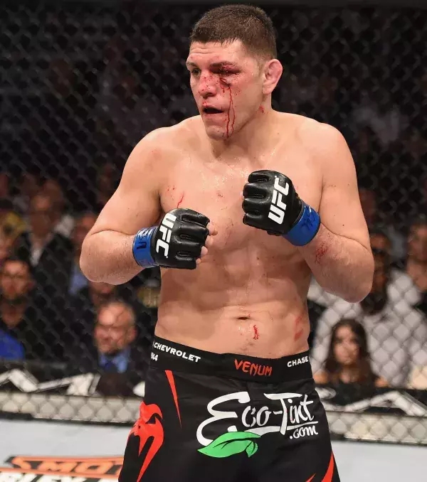 14 - Nick Diaz (MMA)               