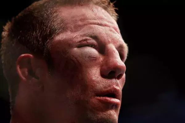 Marcus Davis après son combat contre Nate Diaz 